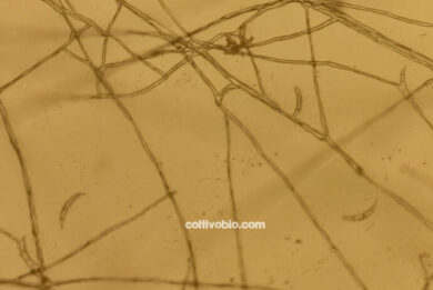 Microscopic image of Fusarium conidia