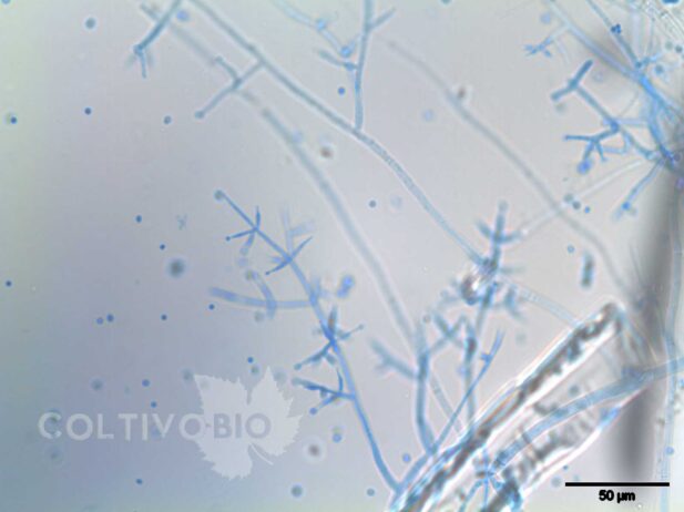 Microscopic image of Trichoderma harzianum. Note the flask-shaped conidiophores ending in a conidium.
